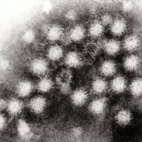Norovirus_4