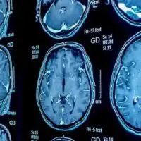 Apr16_Part01_03_Brain