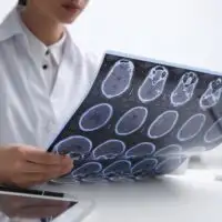 Doctor,Examining,Mri,Images,Of,Patient,With,Multiple,Sclerosis,At