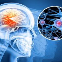 Human,Brain,Damage,And,Treatment,Concept.,3d,Illustration