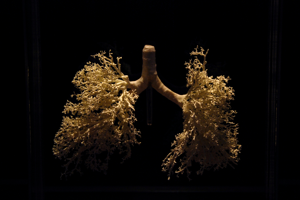 Woman Receives a 3D-Printed Windpipe in Medical First After Cancer Surgery